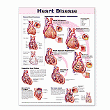 Charts-Heart Disease  (CHT114)