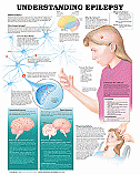 Charts- Understanding Epilepsy  (CHT119)